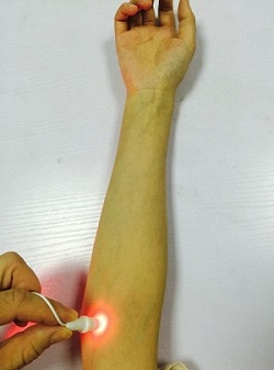 Spooky-cold-laser-twin-connection-3_2