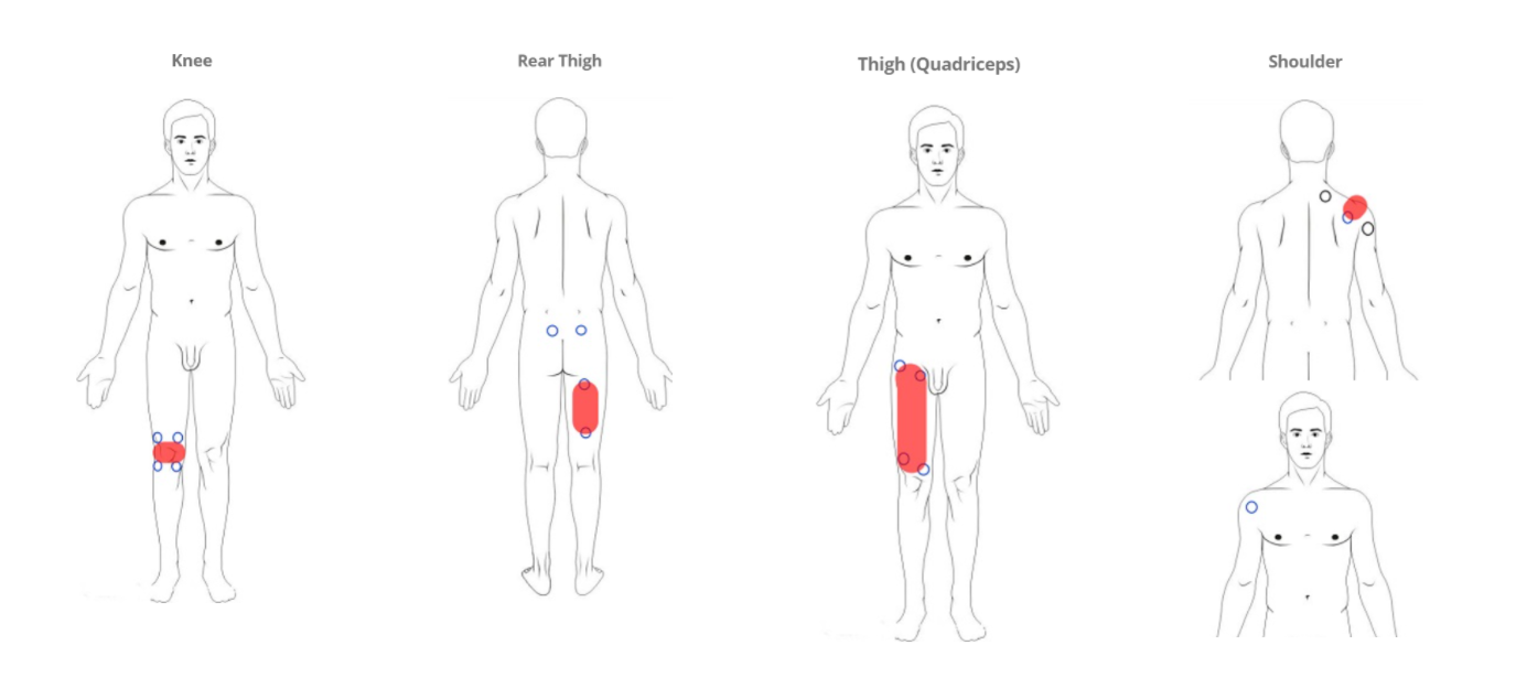 5a1f2a4030a7fe7bb338a437e2df352