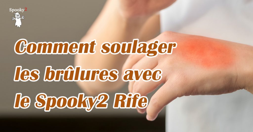 Comment soulager les brûlures avec le Spooky2 Rife Spooky2 Français